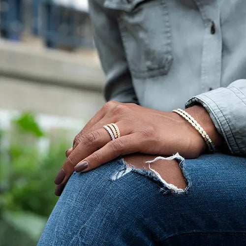 How to Avoid Getting Wedding Ring Rash